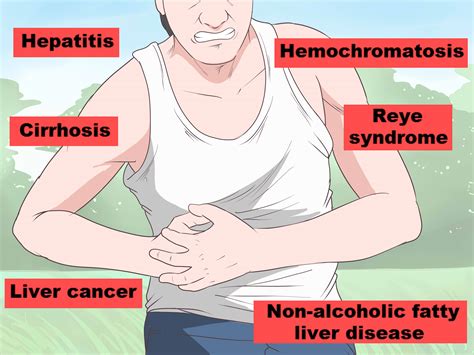 Liver Pain Location Causes Symptoms Treatment - vrogue.co