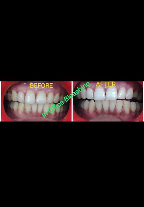 US Bench Test Preparation - Delhi Dental Academy