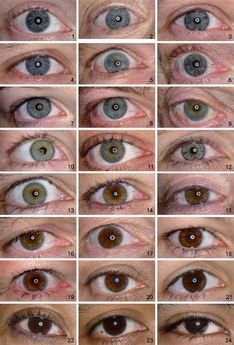 Grading of Iris Color with an Extended Photographic Reference Set | Eye ...