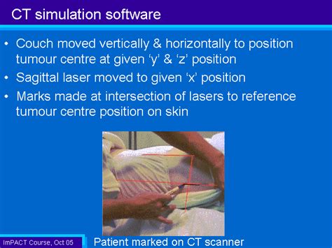 What Is CT Simulation 的图像结果