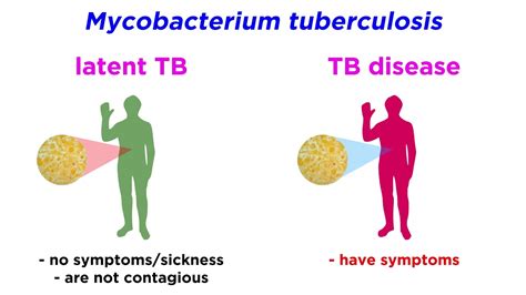 Multidrug-Resistant Tuberculosis (MDR-TB): Mycobacterium tuberculosis ...