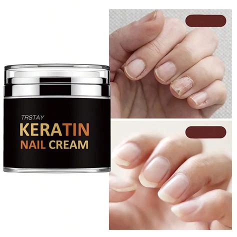 TRSTAY: Nail Care Cream Protects Our Nails, Reduces Nail Fragility ...