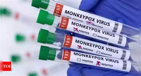 Delhi records 9th monkeypox case; India tally rises to 14 | Delhi News ...