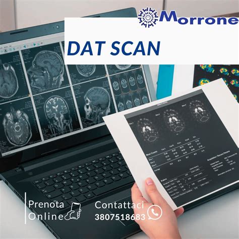 ️È possibile prenotare l’esame diagnostico 𝗗𝗔𝗧 𝗦𝗖𝗔𝗡. | CENTRO MORRONE