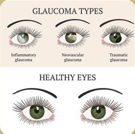 How Smoking and Alcohol Affect Your Eyes: What You Need to Know