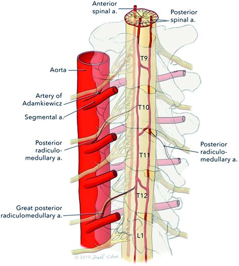 Artery Of Adamkiewicz Diagram