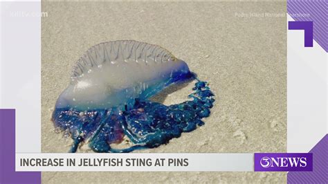 Beach Safety: Jellyfish and Stingrays | kiiitv.com