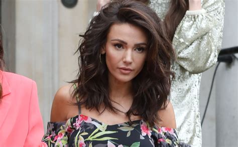 Michelle Keegan Face Surgery