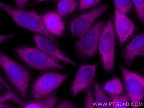 Spartin/SPG20 antibody (CL647-13791) | Proteintech