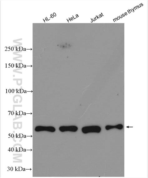 ROD1 antibody (14027-1-AP) | Proteintech