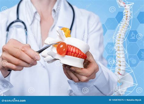 A Doctor Pointing at Herniated Disc Inflammation with Tweezers Stock Image - Image of hernia ...