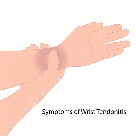 Vector Outline Of Wrist Pain From Sudden Injuries Vector, Bones, Illustration, Wrist PNG and ...
