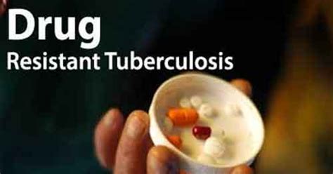 NICE Guidelines on Drug-resistant TB