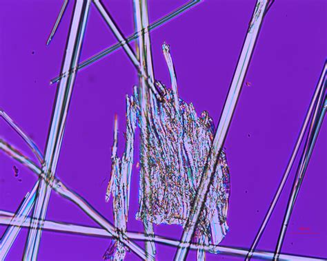 Polarizing Light Microscope 的图像结果