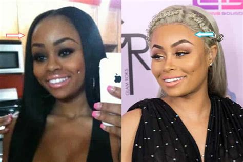 Blac Chyna's Transformation: Uncovering The Journey Behind The Headlines