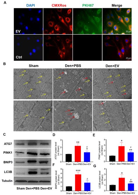 SKP-SC-EVs Mitigate Denervated Muscle Atrophy by Inhibiting Oxidative ...