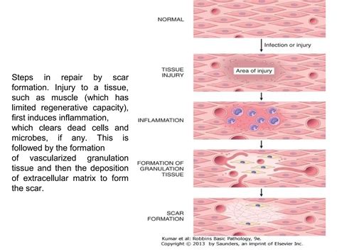Tissue repair, regeneration and wound healing (1) | PPT
