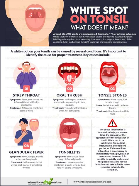 White Sore On Tonsil Tonsil Stone | Cause, Symptoms, Treatment