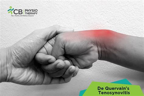 Best Treatment for De Quervain's Tenosynovitis in Hyderabad | Book ...