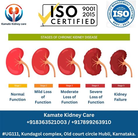 Know the 5 Stages of Chronic Kidney Disease (CKD) Stage 1: Kidneys work… | Dr Shidram Kamate