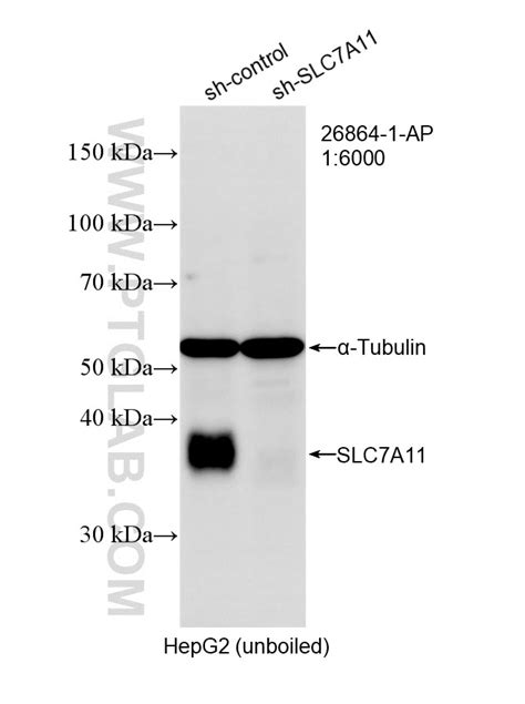 SLC7A11/xCT antibody (26864-1-AP) | Proteintech