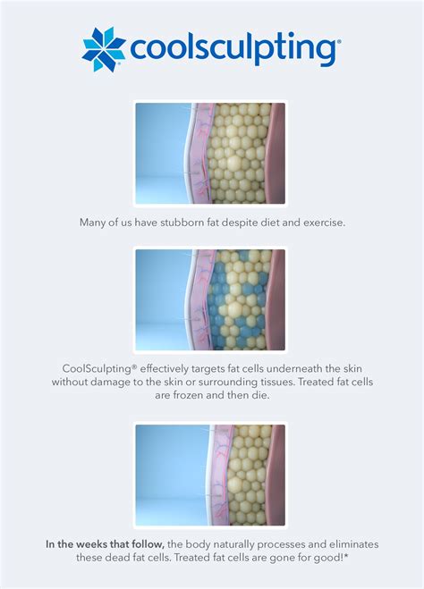 Coolsculpting - Skin Tight Aesthetics & Wellness