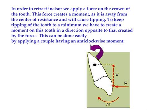 Biomechanics in Orthodontics | PPT