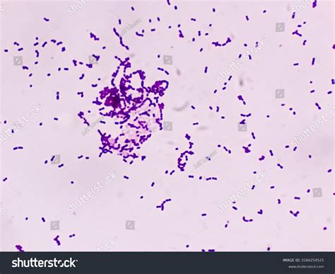 K Pneumoniae Gram Stain Klebsiella Pneumoniae | Bacterium | Britannica