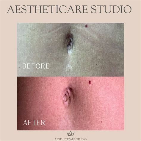 Brittny Rust Medical Tattoo Nurse, MBA, RN-BSN (@aestheticare.studio ...