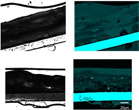 New Functions of Low-Molecular-Weight Hyaluronic Acid on Epidermis ...