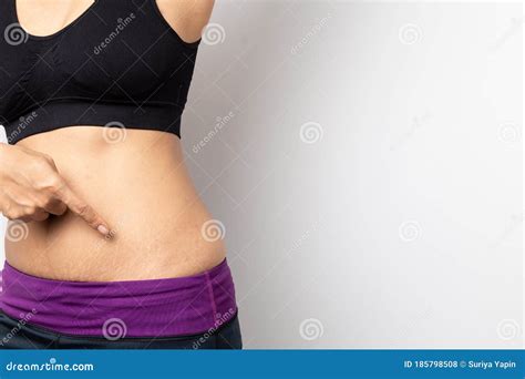 Women Show Off the Belly after Birth. Stretch Marks on White Background ...