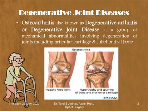 SOLUTION: Degenrative joint disease - Studypool