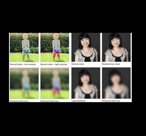 What Is legal blindness?