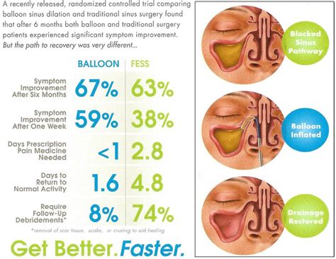 Endoscopic Sinus Surgery - Vegas Breathe Free