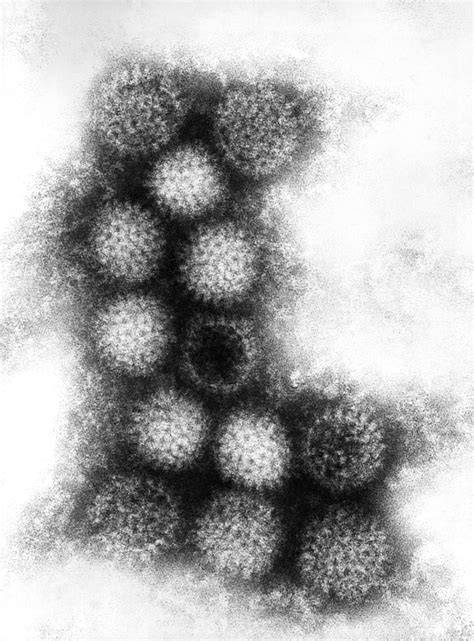 Free picture: irituia, strain, changuinola, virus, member, genus, orbiviruses