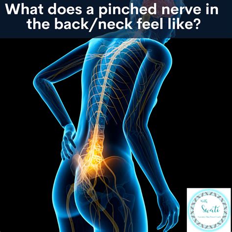 What does a pinched nerve in the back/neck feel like? | Swati Prakash