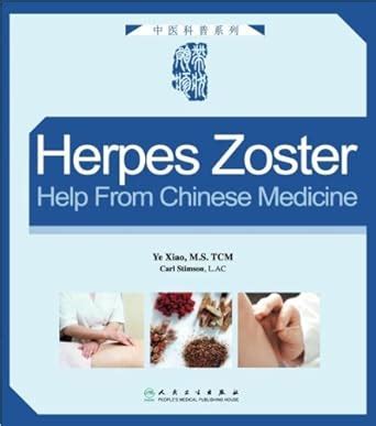 Herpes Zoster: Help from Chinese Medicine : Xiao, Ye: Amazon.in: Books