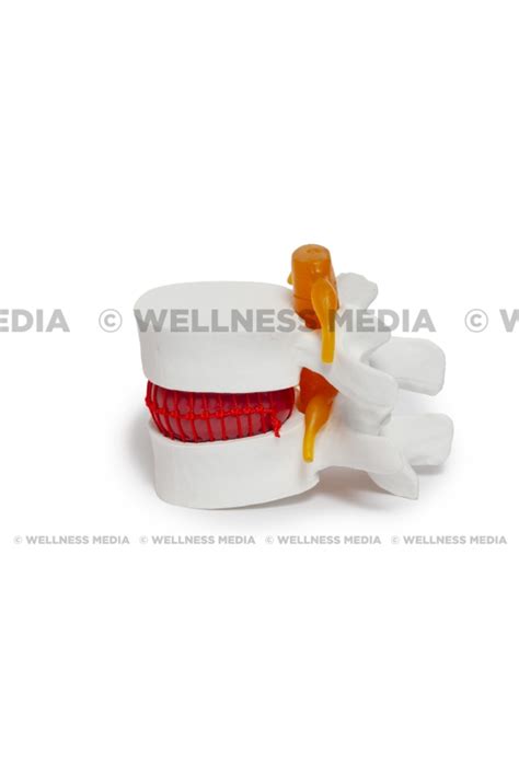 Disk Problem 的图像结果