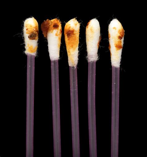 Ear Infection Or Wax at Troy Ritchie blog