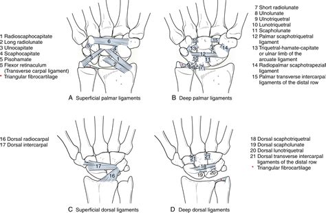 Carpal Instability - Clinical Tree