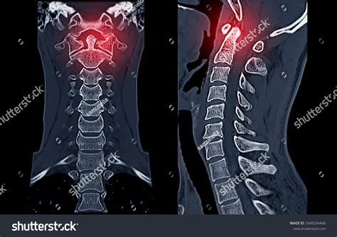 What Is Dens In Medicine at Stephanie Gaspard blog