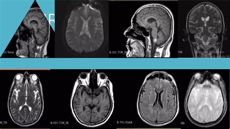 Magnetic Resonance Angiography and Venography | PPTX