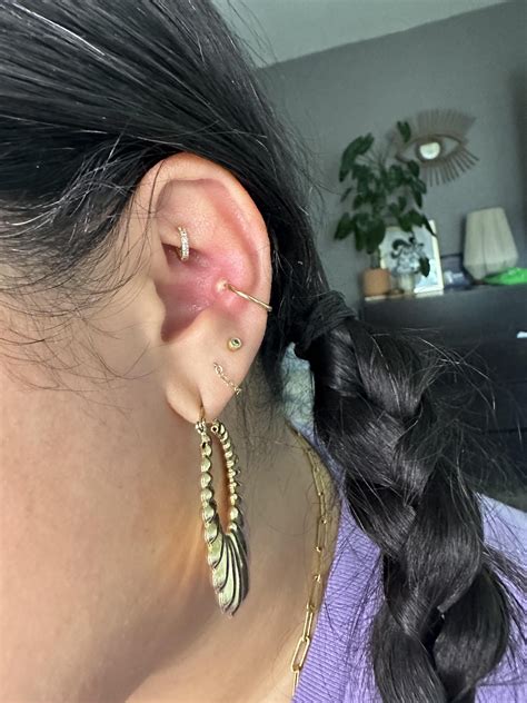 irritation bump? : r/piercing