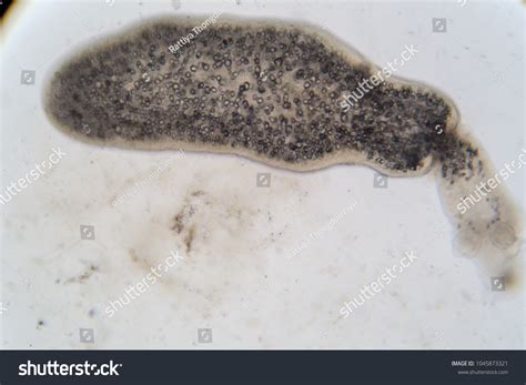 58 Taenia spp egg 이미지, 스톡 사진 및 벡터 | Shutterstock