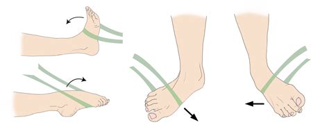 Sprained Ankle - OrthoInfo - AAOS