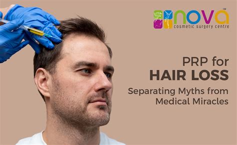 PRP for Hair Loss: Separating Myths from Medical Miracles | Nova