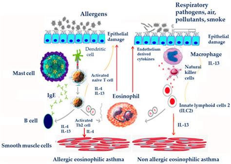 Acute Severe Asthma in Adolescent and Adult Patients: Current ...