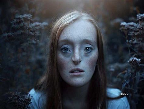 Rare facial defect doesn't stop this German model Ilka Brühl from ...