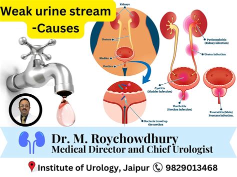 Splitting Urine Stream