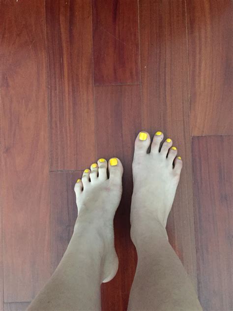 Why My Feet Are Yellow at Tamara Juarez blog